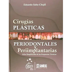 Cirugías Plásticas Periodontales y Periimplantarias