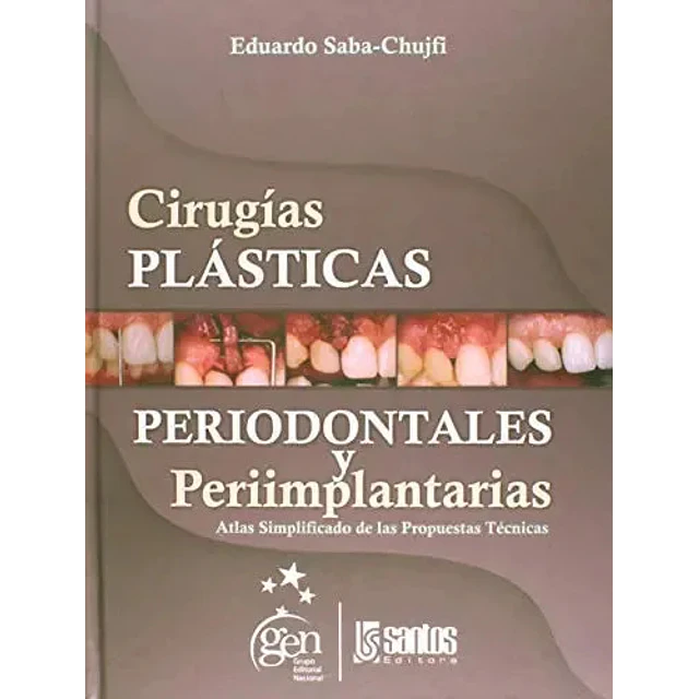 Cirugías Plásticas Periodontales y Periimplantarias