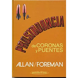 Prostodoncia de coronas y puentes