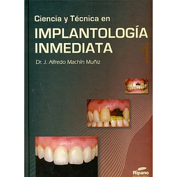 Ciencia y Tecnica en Implantologia Inmediata - 2 Tomos