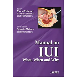 Manual on IUI What, When and Why