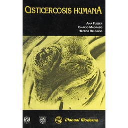 Cisticercosis Humana