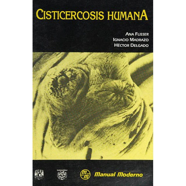 Cisticercosis Humana
