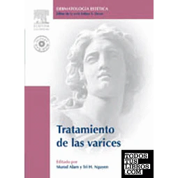 Dermatologia Estetica Tratamiento de las Varices