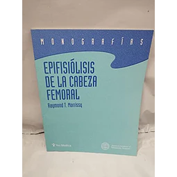Epifisiolisis de la cabeza femoral
