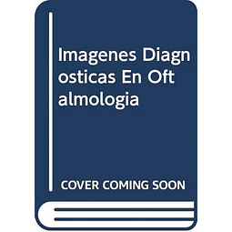 Imagenes diagnosticas en oftalmogia