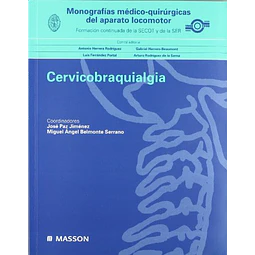 Cervicobraquialgia
