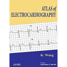 Atlas of Electrocardiography
