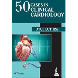 50 Cases in clinical cardiology