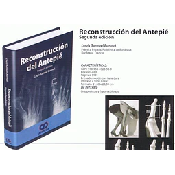 Reconstrucción del Antepié