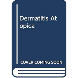 Dermatitis atopica