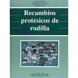 Recambios prosteticos de rodilla