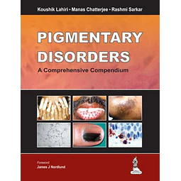 Pigmentary Disorders