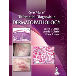 Color Atlas of Differential Diagnosis in Dermatopathology