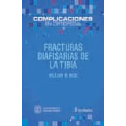 Fracturas Diafisarias de la Tibia