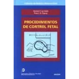 Procedimientos de control fetal