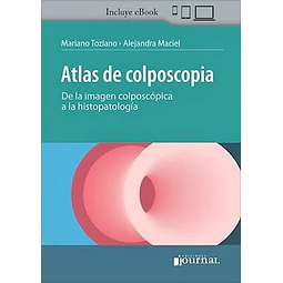 Atlas de colposcopia. De la imagen colposcópica a la histopatología
