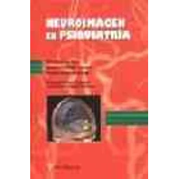 Neuroimagen en psiquiatría