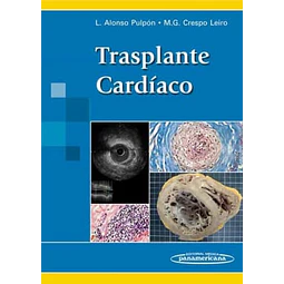 Trasplante Cardíaco