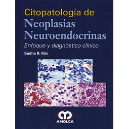 Citopatología de neoplasias neuroendócrinas