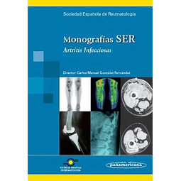 Monografías SER. Artritis Infecciosa