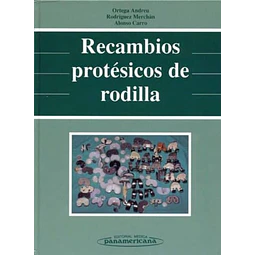 Recambios prosteticos de rodilla