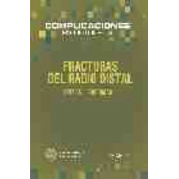 Fracturas del Radio Distal