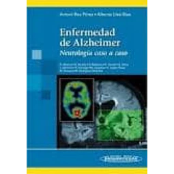 Enfermedad de Alzheimer