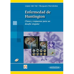 Enfermedad de Huntington