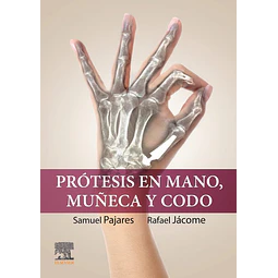 Prótesis en mano, muñeca y codo