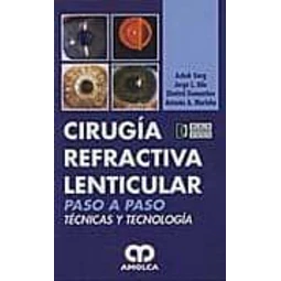 Cirugía Refractiva Lenticular