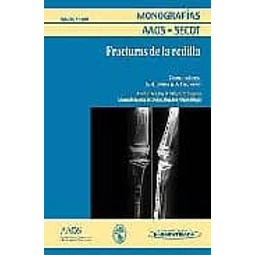 Fracturas de Rodilla Monografías AAOS-SECOT Número 2 / 2009