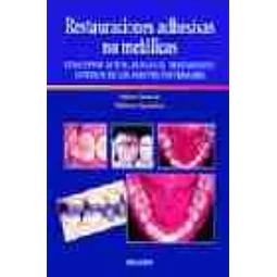 Restauraciones adhesivas no metalicas