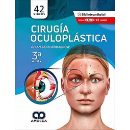 Cirugía oculoplástica