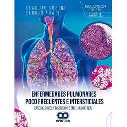 Enfermedades pulmonares poco frecuentes e intersticiales