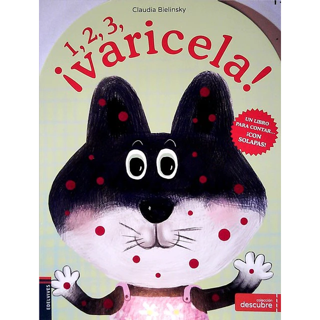 1 2 3... ¡Varicela!