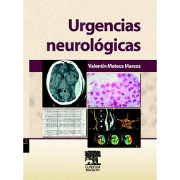 Urgencias neurológicas