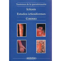 Ictiosis : estados ictiosiformes : trastornos de la queratinizacion