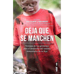 Deja que se manchen