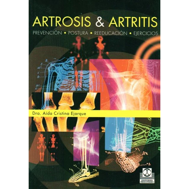 Artrosis & artritis