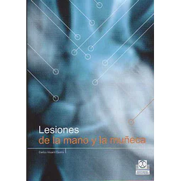 Lesiones de la mano y la muñeca