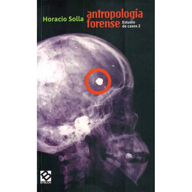 Antropologia forense. Estudio de casos 2