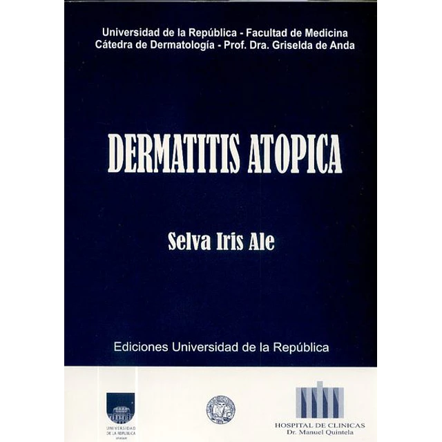 Dermatitis atopica