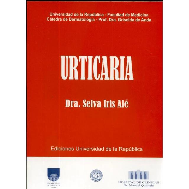 Urticaria