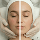 Mesoterapia Facial (Vitaminas Faciales) - Estudio NathyColores - Miniatura 3