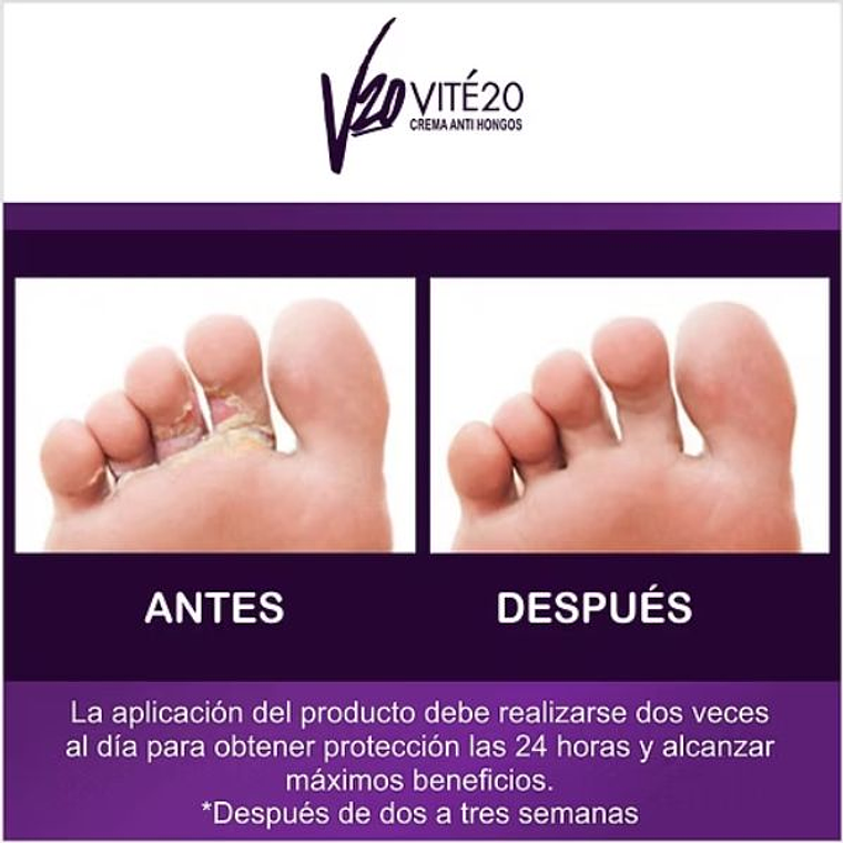 VITÉ 20 Spray (Elimina mal Olor de Pies y Calzado) 3
