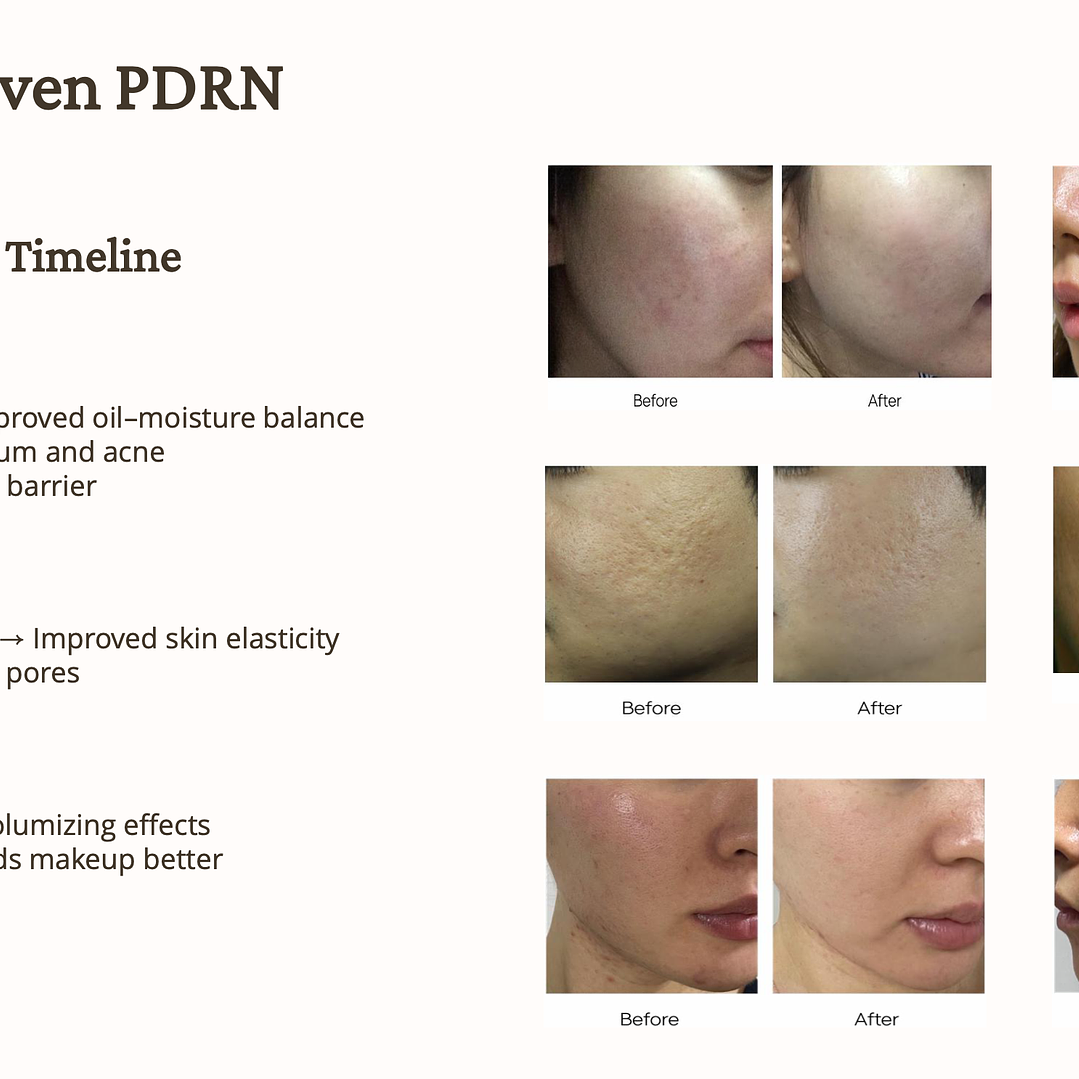 PRONTO DISPONIBLE ! Crema Regenerativa REJUVEON 5