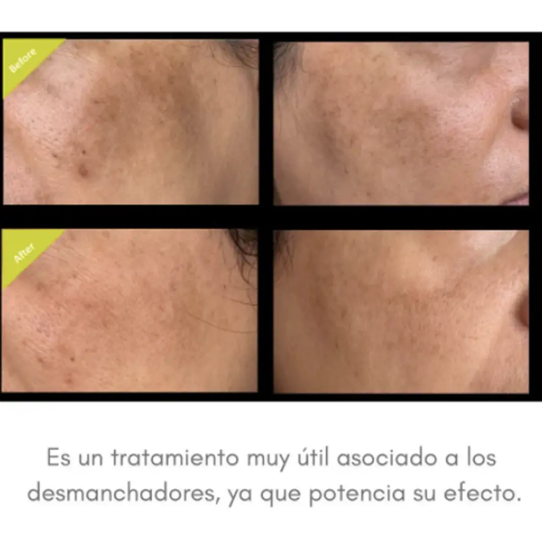 Pack de 3 unidades de GliSODin 2
