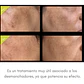 Pack de 3 unidades de GliSODin - Miniatura 2