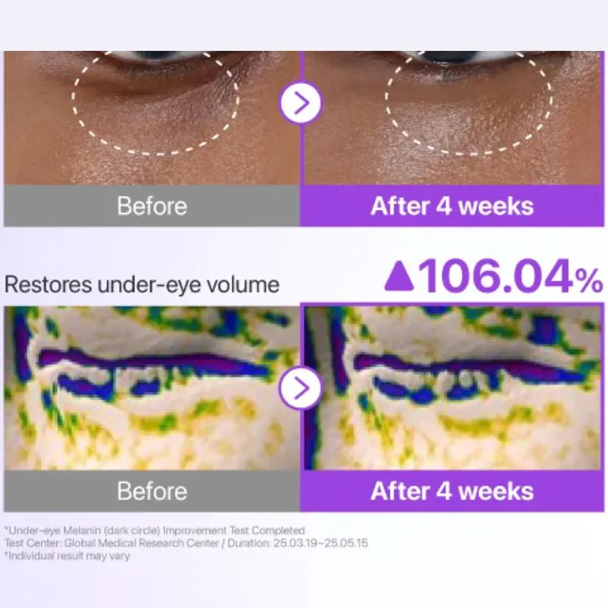 numbuzin - Crema Contorno de Ojos No.9 NAD+ Retinol Volumetox Eye Cream 3